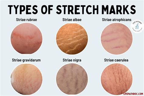 Do Dogs Get Stretch Marks? And Why Do Cats Always Land on Their Feet?